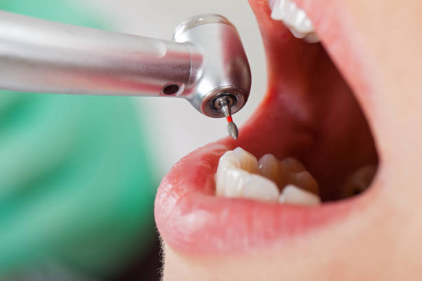 Best Urgent Tooth Repair  in Balmville, NY